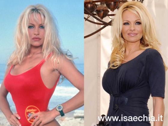 Pamela Anderson - Casey Jean Parker